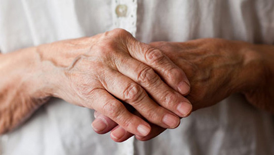 ¿Qué es la artritis reumatoide?
