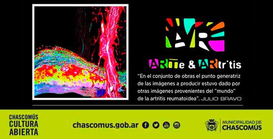 muestra Arte & Artritis