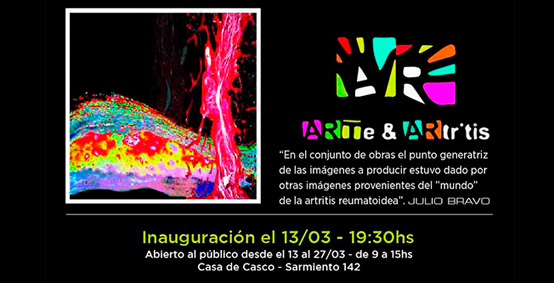 Muestra Arte & Artritis 