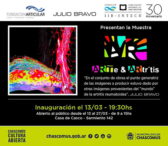 Muestra Arte & Artritis 