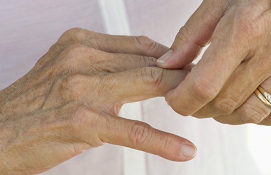 Curso de evaluación articular en la artritis reumatoidea dirigido a personal de la salud
