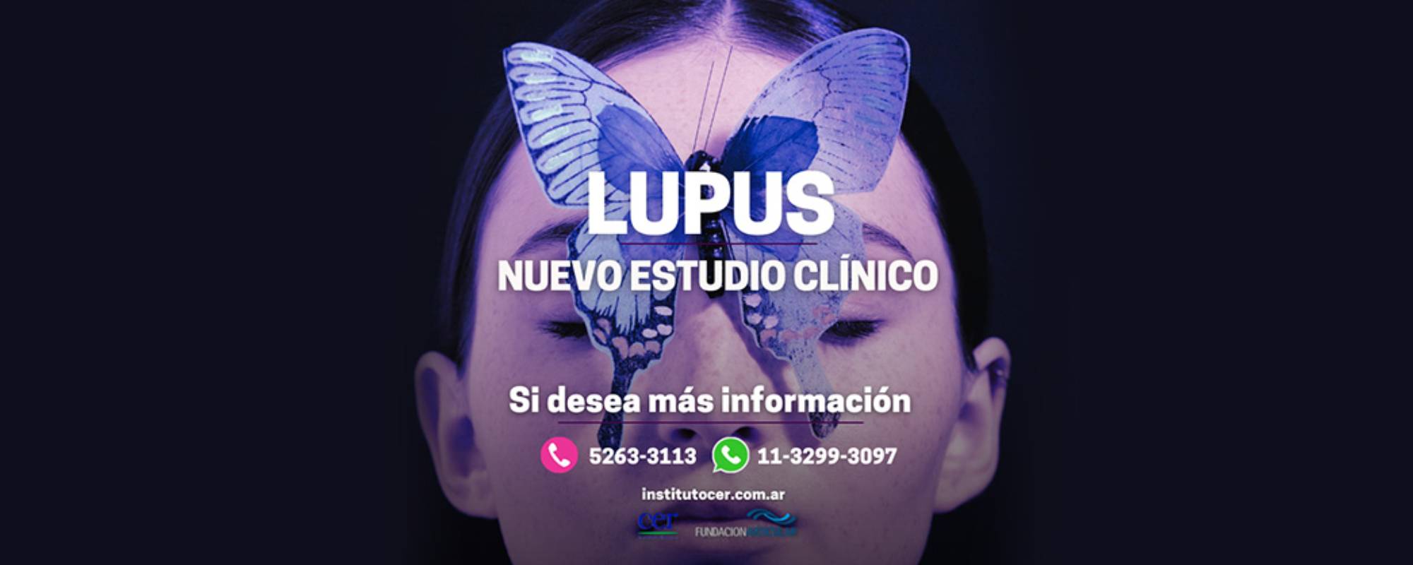 Lupus